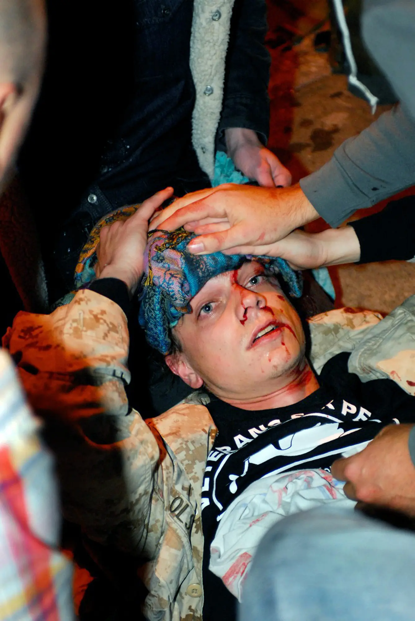 Scott Olsen bleeds from his head as a crowd of people come to his aid.