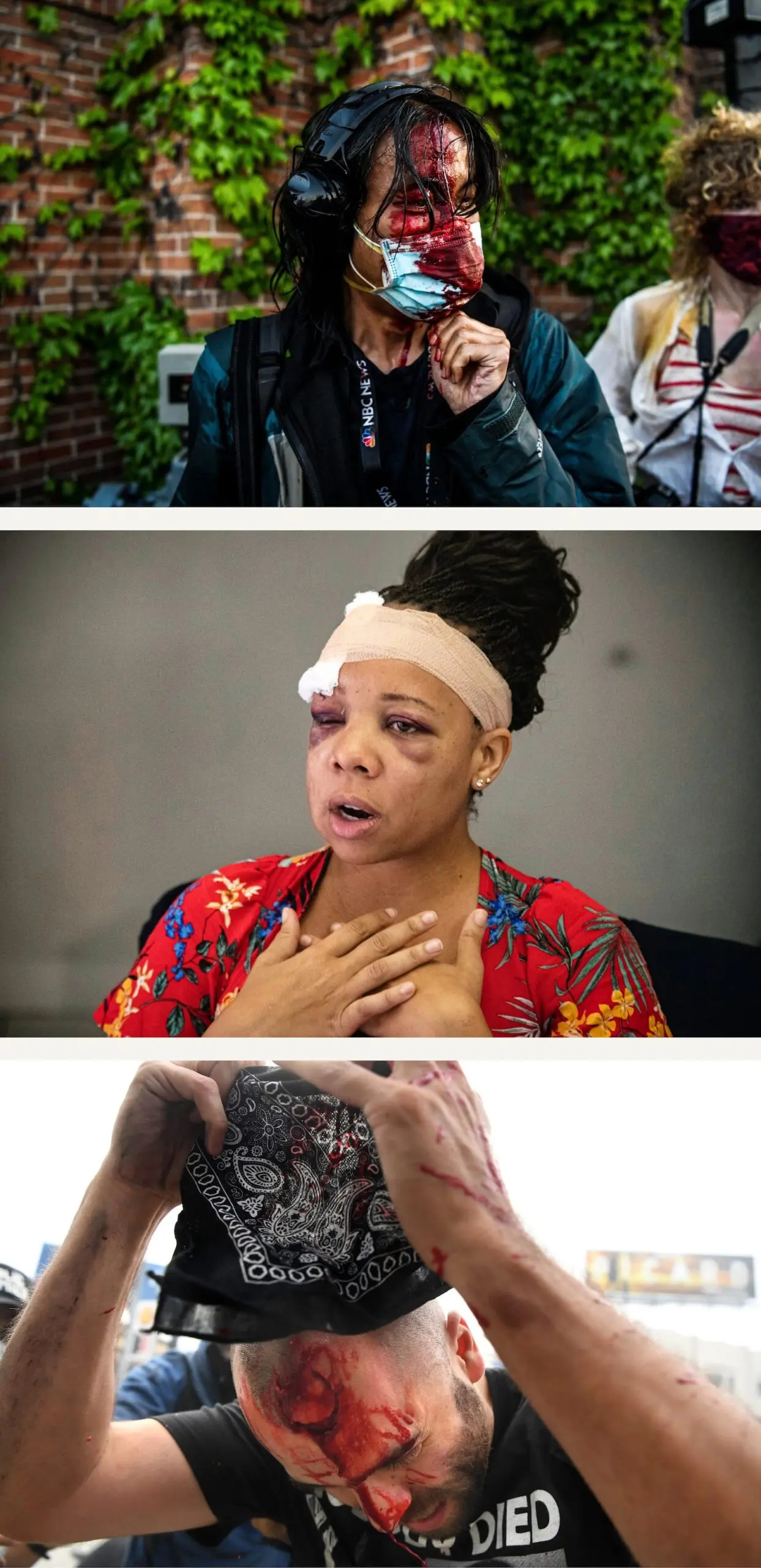 Three images, from top: A man bleeds from a wound on his head while wearing a surgical mask, a woman with a head wound and black eyes speaks, a man holds a hankercheif near a bleeding wound in his forehead.