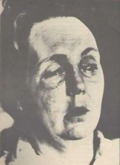 A portrait of Emma Groves after she was blinded by a rubber bullet, taken for a poster produced by the United Campaign Against Plastic Bullets.